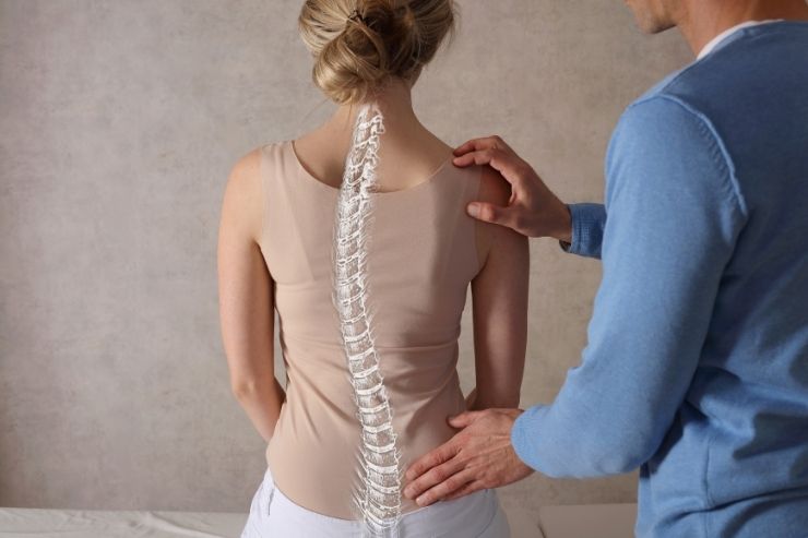 Scoliosis